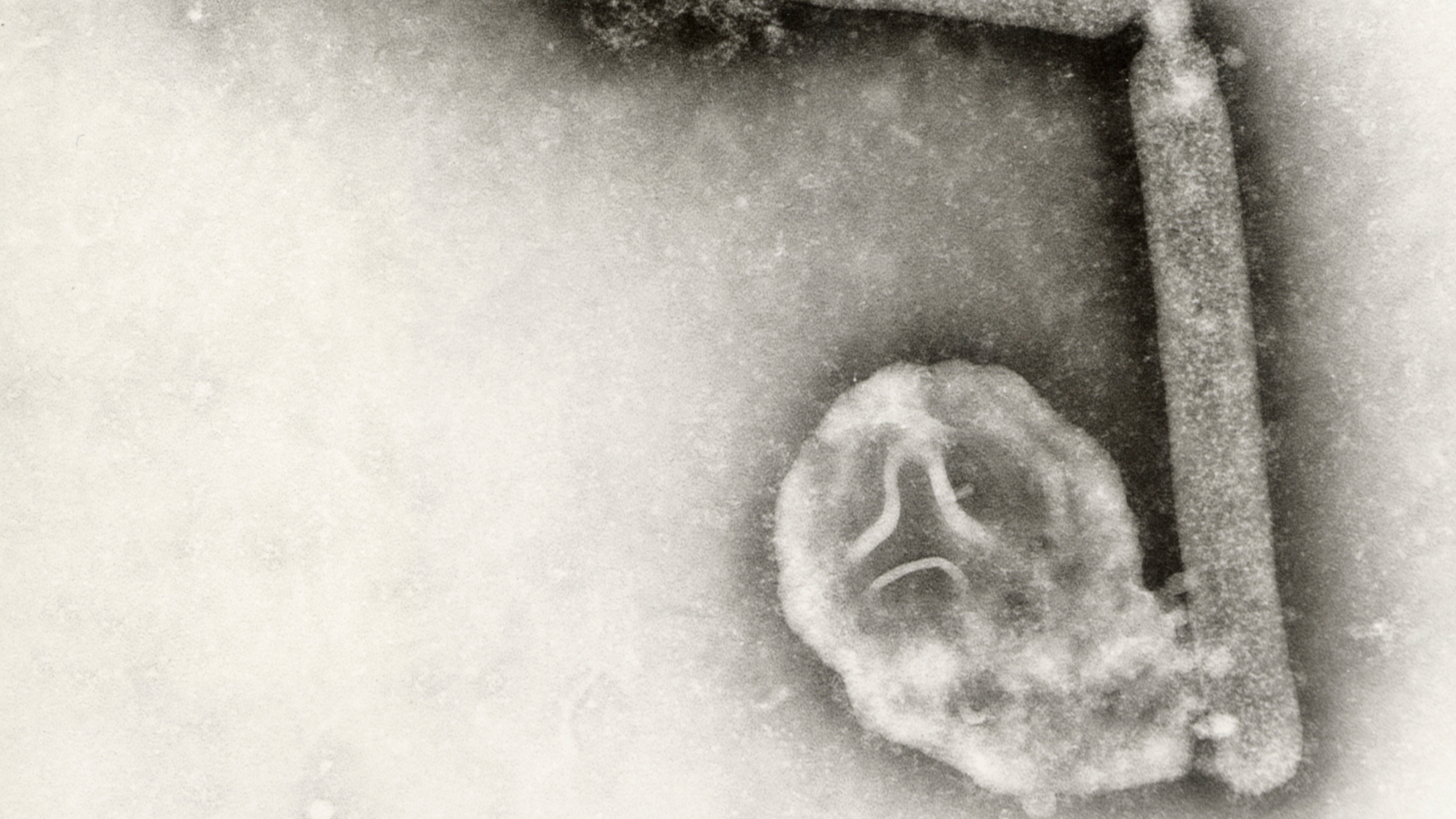 Australian govt confirms first mainland case of H5N1 bird flu strain